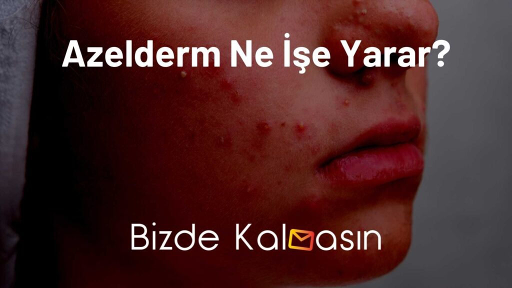 Azelderm Ne İşe Yarar