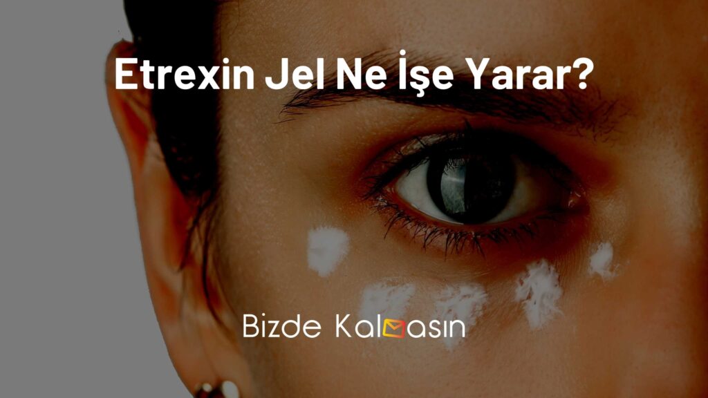 Etrexin Jel Ne İşe Yarar