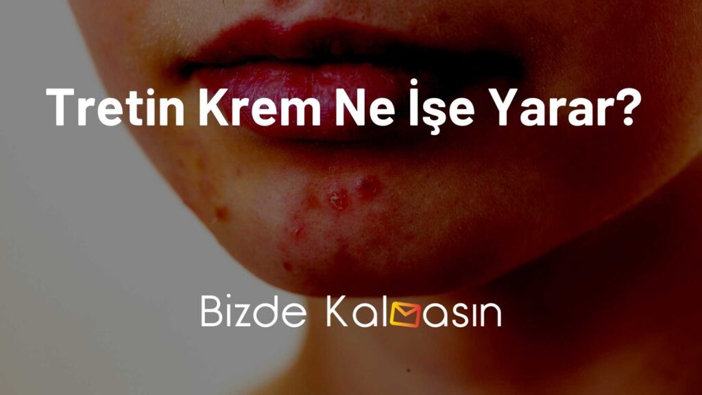 Tretin Krem Ne İşe Yarar?