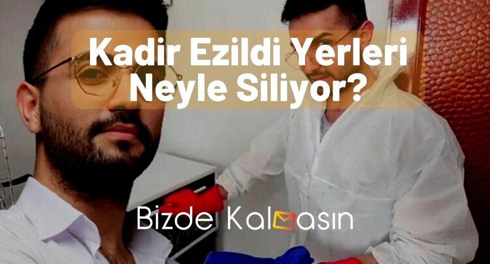 Kadir Ezildi Yerleri Neyle Siliyor