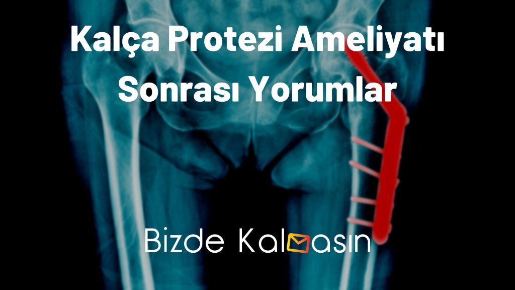 Kalça Protezi Ameliyatı Sonrası Yorumlar