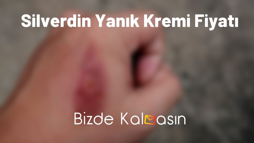 Silverdin Yanık Kremi Fiyatı