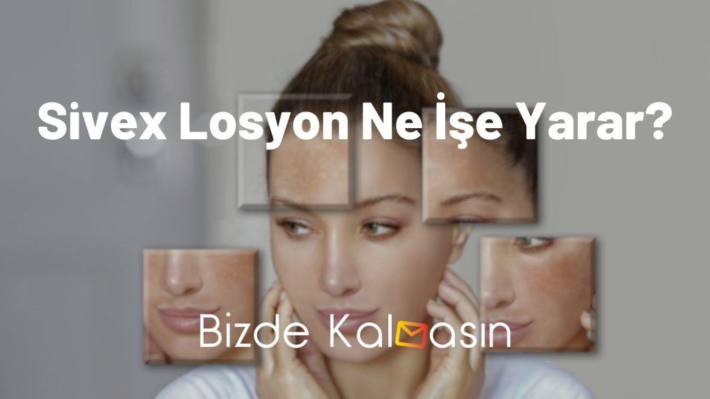 Sivex Losyon Ne İşe Yarar