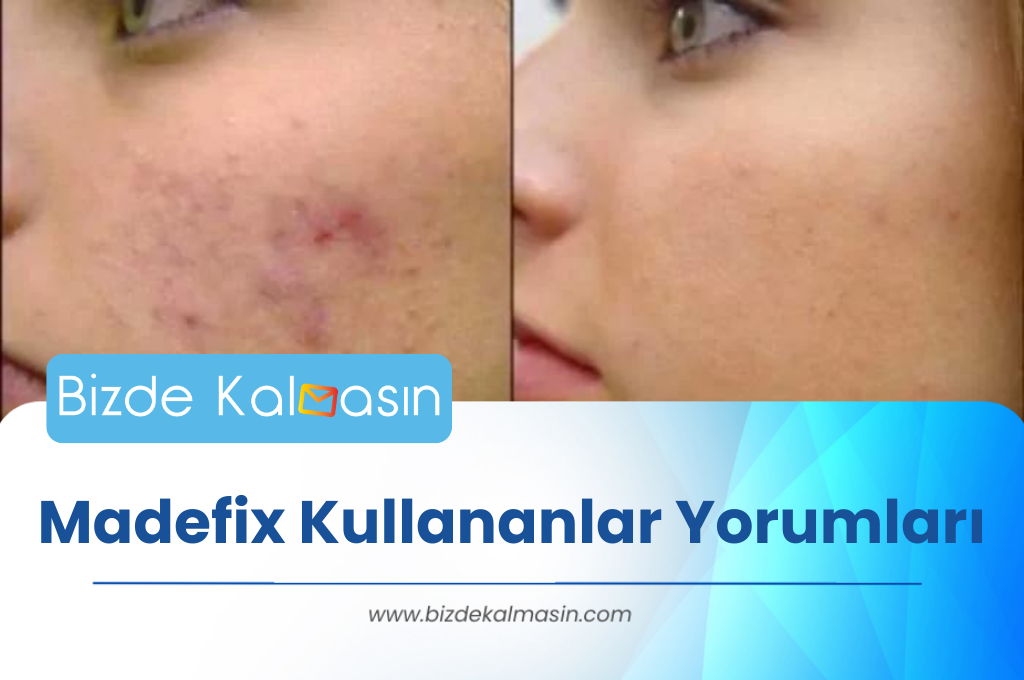 Madefix Kullananlar Yorumları