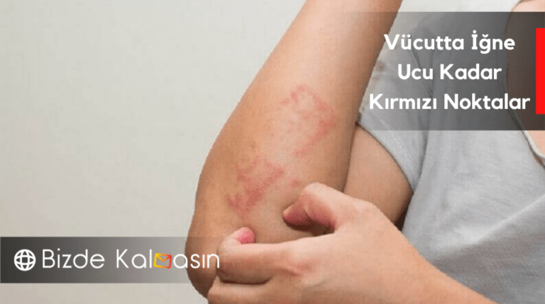 v-cutta-ne-ucu-kadar-k-rm-z-noktalar-nas-l-ge-er-bizde-kalmas-n