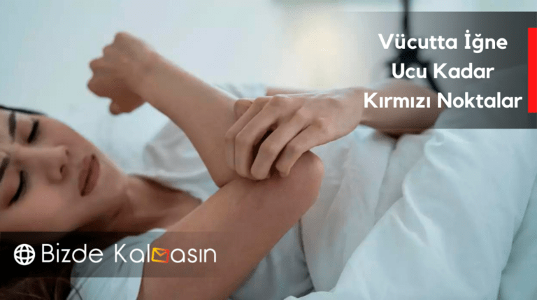 Vücutta İğne Ucu Kadar Kırmızı Noktalar – Nasıl Geçer  ?