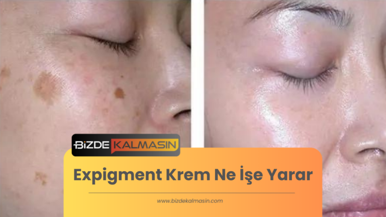 Expigment Krem Ne İşe Yarar – Fiyatları 2024