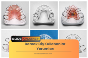 Damak Diş Kullananlar Yorumları