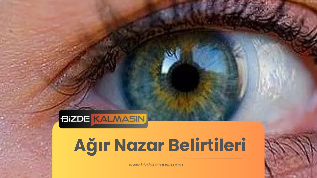 Ağır Nazar Belirtileri ve Tedavi Yöntemleri Ağır Nazar Belirtileri