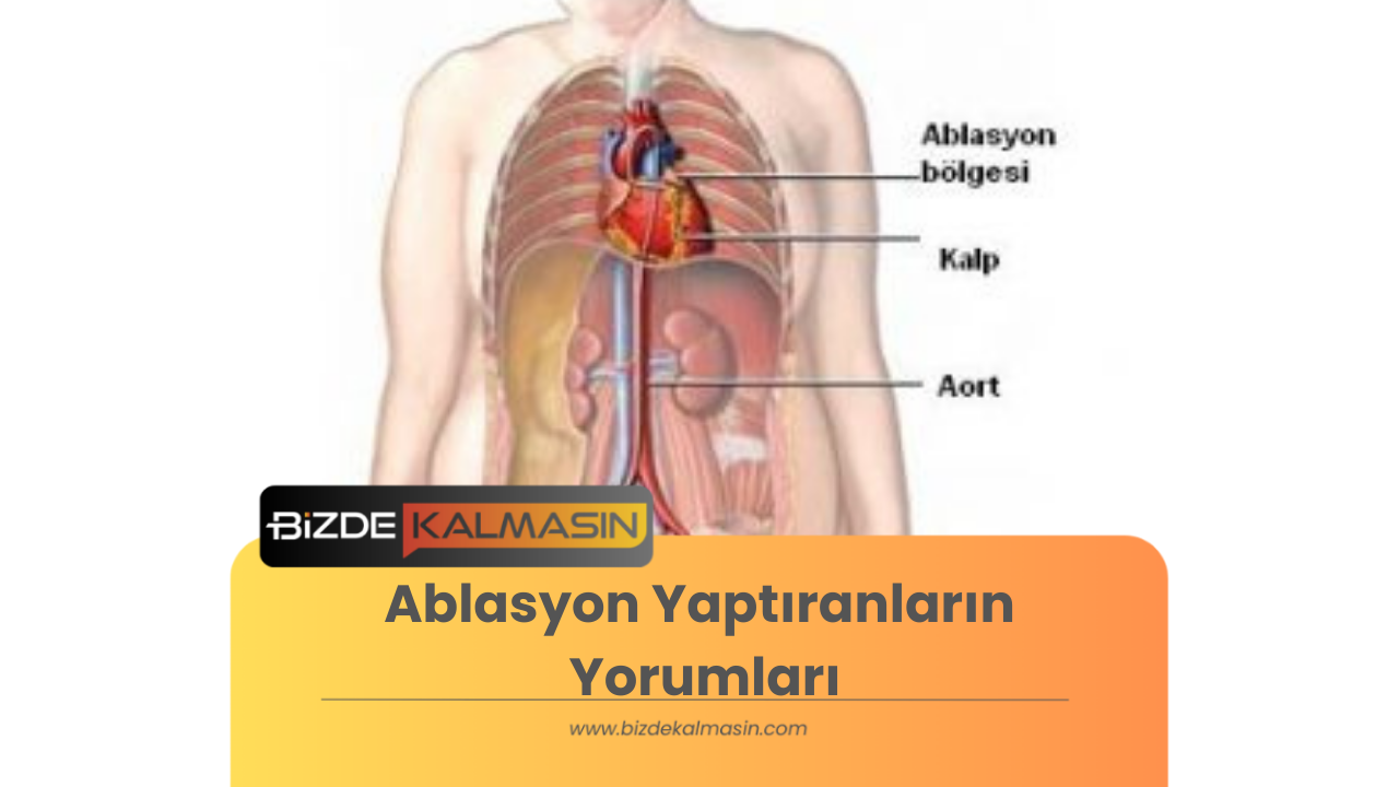 Ablasyon Yaptıranların Yorumları - Kalp Ablasyon Sonrası Ablasyon Yaptıranların Yorumları