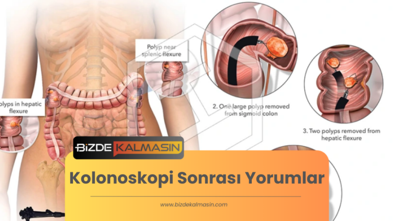 Kolonoskopi Sonrası Yorumlar – Devlet Hastanesinde Kolonoskopi