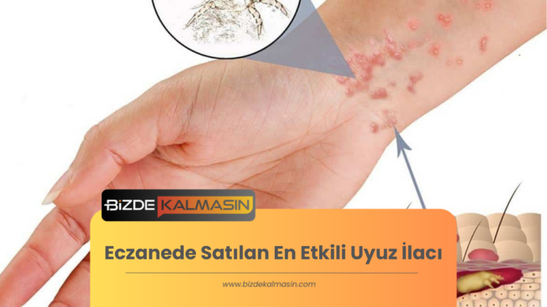 Eczanede Satılan En Etkili Uyuz İlacı 2023 – İsimleri Ve Fiyatları