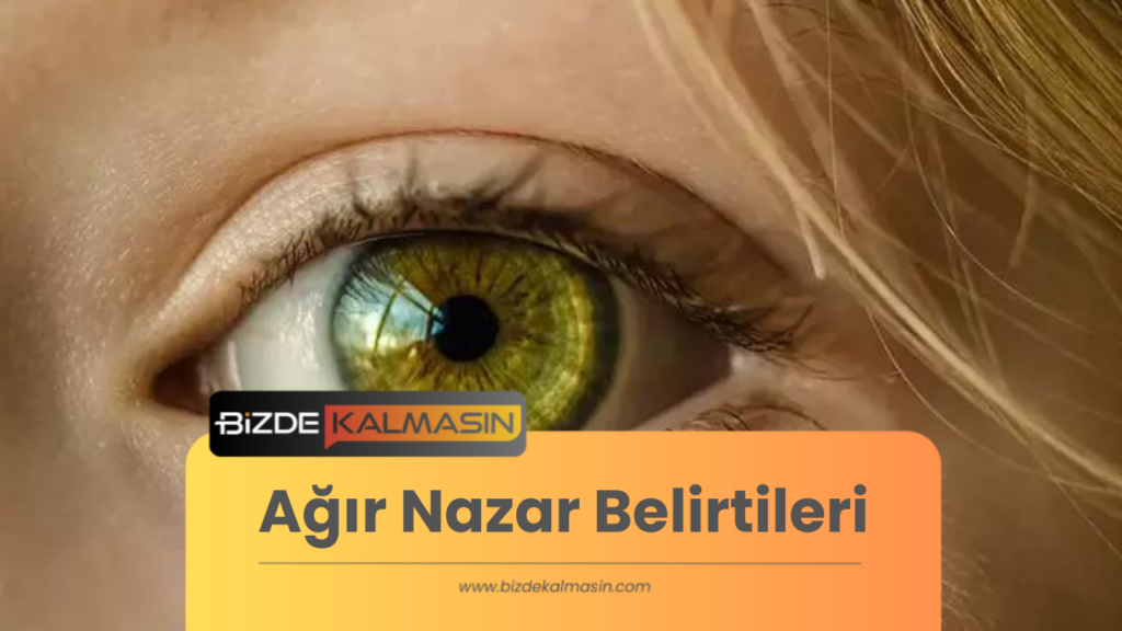 Ağır Nazar Belirtileri