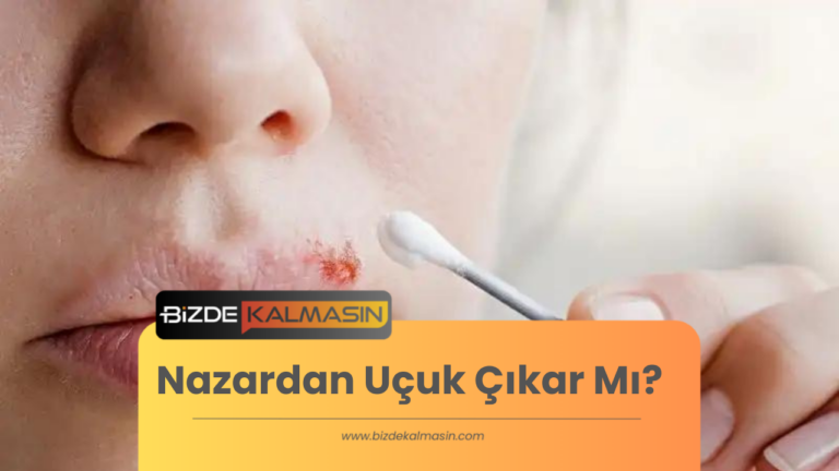 Nazardan Uçuk Çıkar Mı?