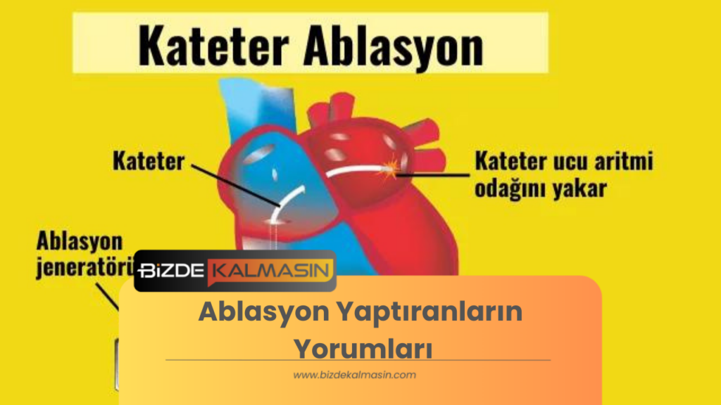 Ablasyon Yaptıranların Yorumları