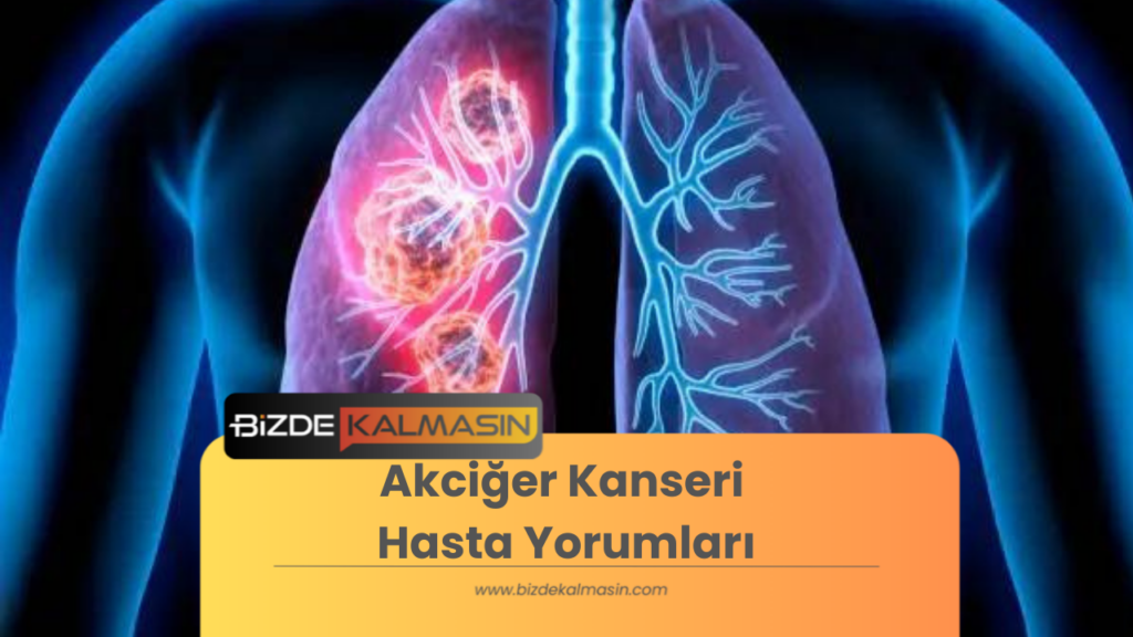 Akciğer Kanseri Hasta Yorumları