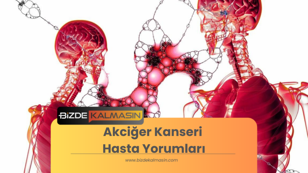 Akciğer Kanseri Hasta Yorumları