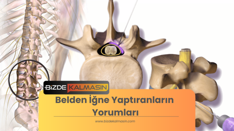 Belden İğne Yaptıranların Yorumları