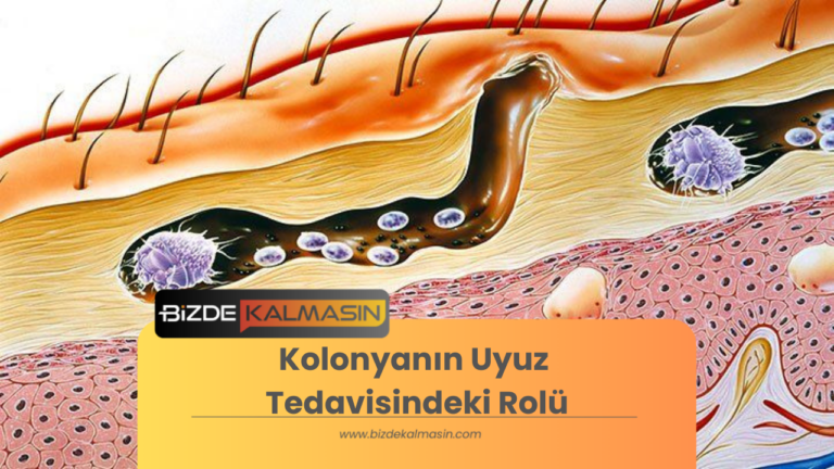 Kolonyanın Uyuz Tedavisindeki Rolü