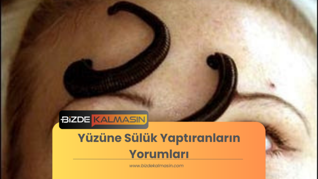 Yüzüne Sülük Yaptıranların Yorumları 