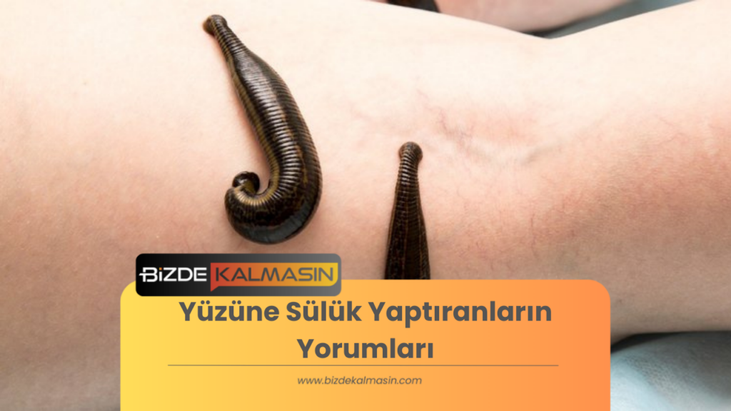 Yüzüne Sülük Yaptıranların Yorumları 