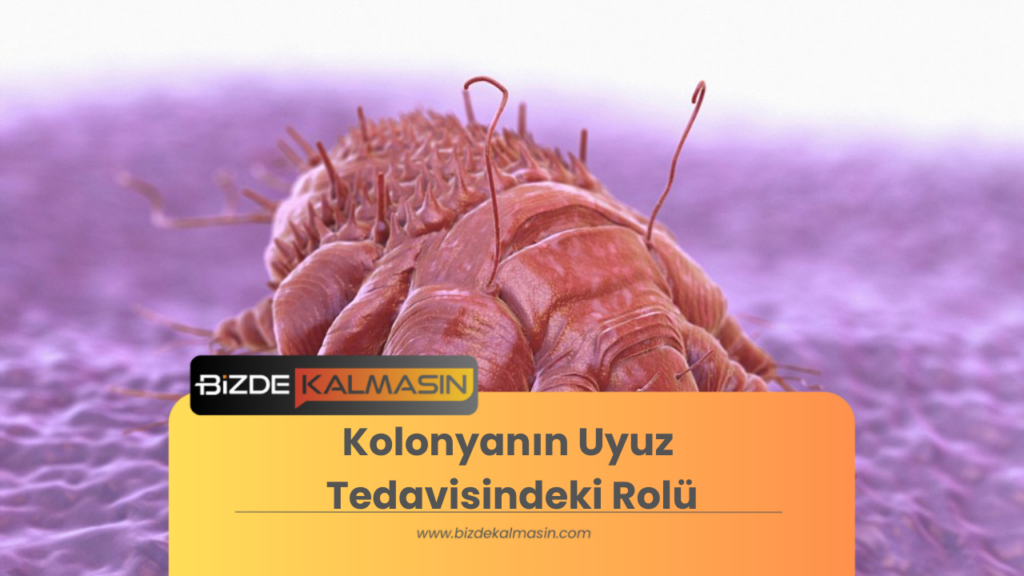 Kolonyanın Uyuz Tedavisindeki Rolü