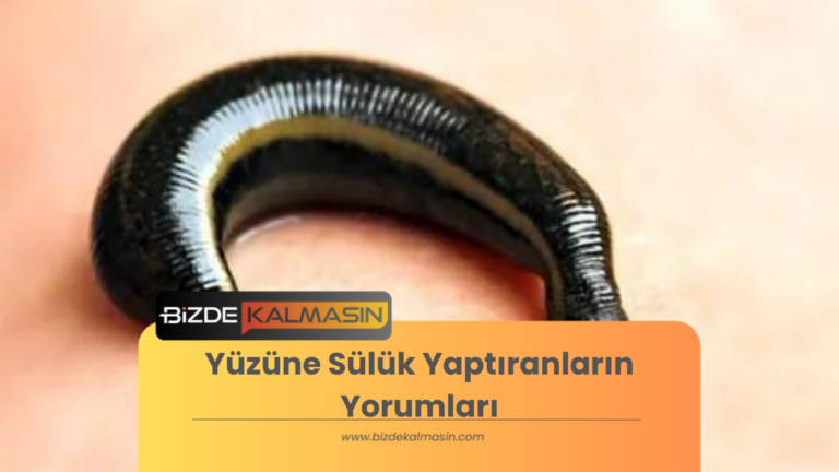 Yüzüne Sülük Yaptıranların Yorumları