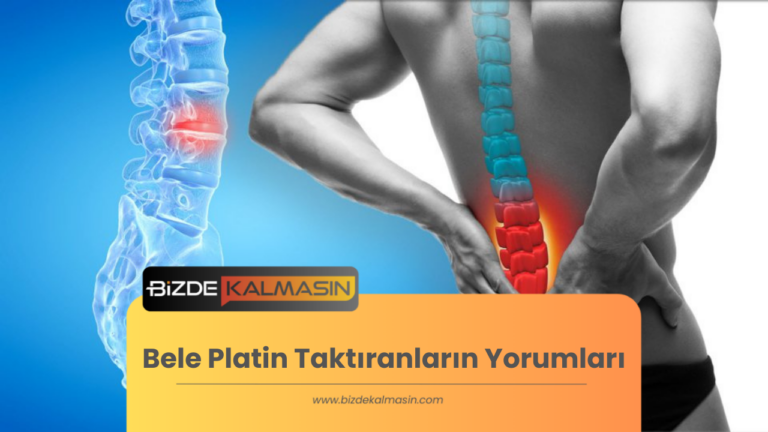 Bele Platin Taktıranların Yorumları