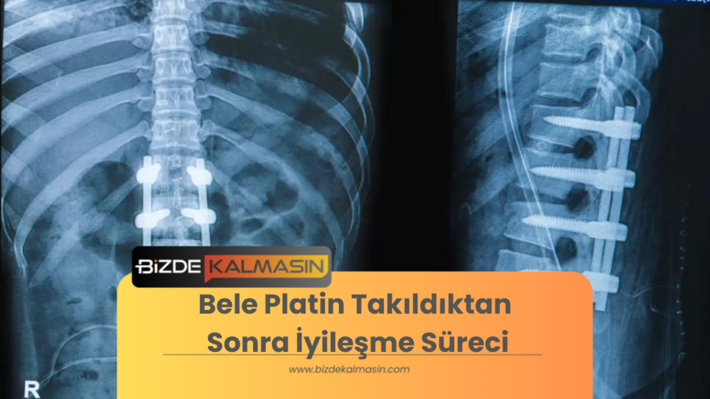 Bele Platin Takıldıktan Sonra İyileşme Süreci