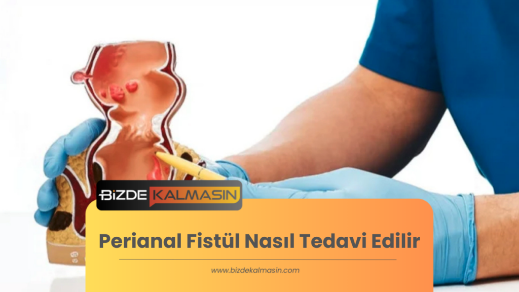 Perianal Fistül Nasıl Tedavi Edilir?