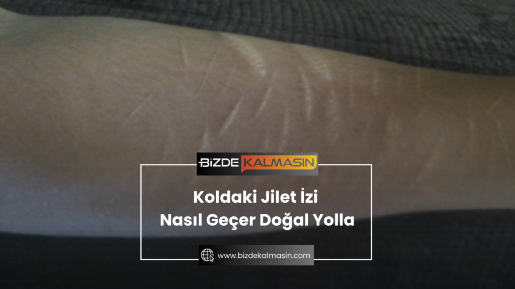 Koldaki Jilet İzi Nasıl Geçer Doğal Yolla