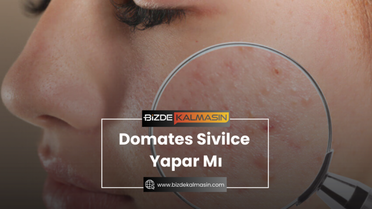 Domates Sivilce Yapar Mı – Yumurta ve Sivilce İlişkisi