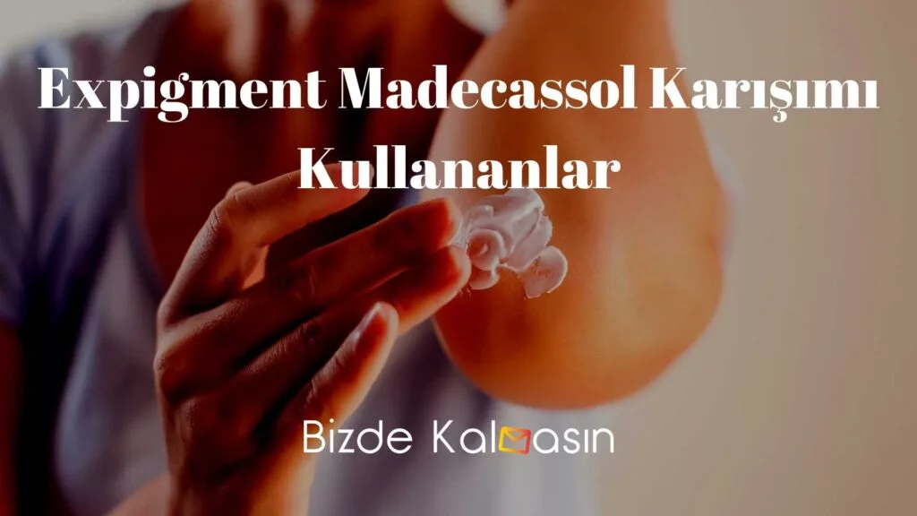 Expigment Madecassol Karışımı Kullananlar