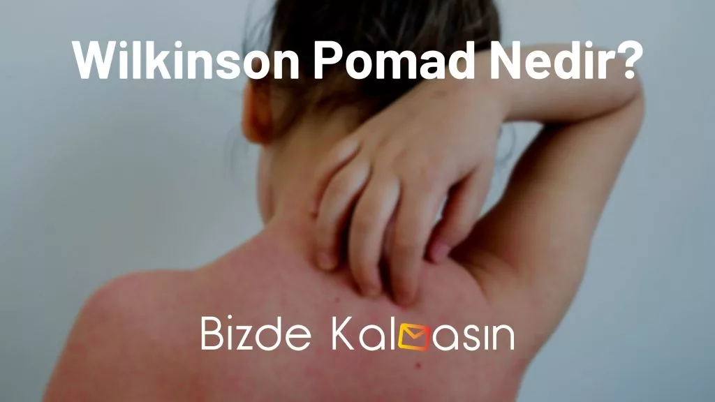 Wilkinson Pomad Nedir?