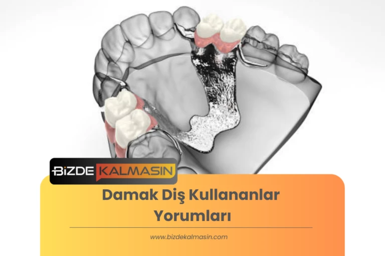 Damak Diş Kullananlar Yorumları – Damak Diş Protezi Nedir?