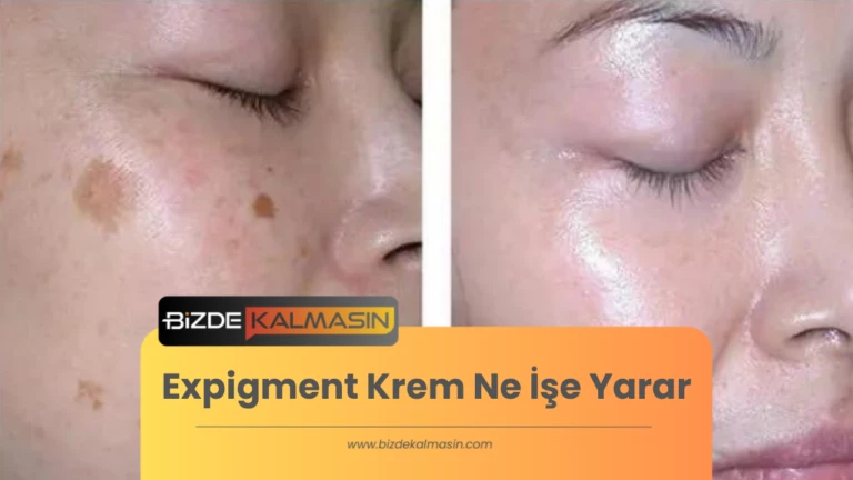 Expigment Krem Ne İşe Yarar