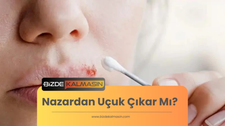 Nazardan Uçuk Çıkar Mı? – Durduk Yere Neden Uçuk Çıkar?