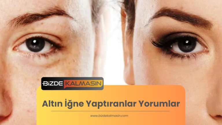 Altın İğne Yaptıranlar Yorumlar