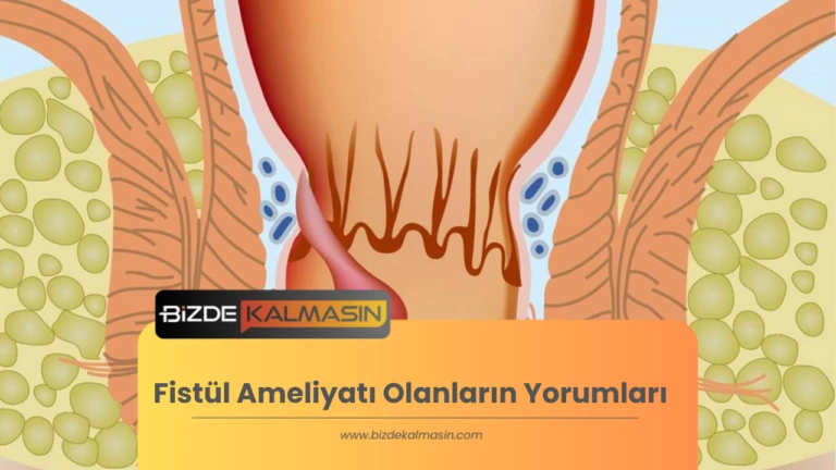 Fistül Ameliyatı Olanların Yorumları