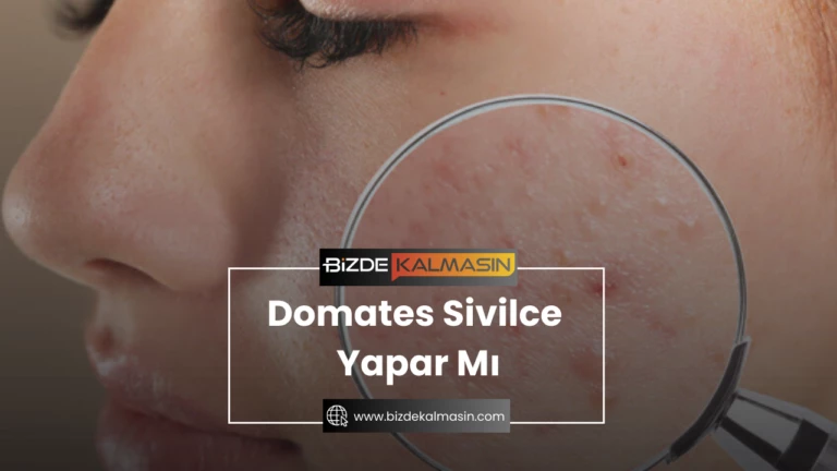 Domates Sivilce Yapar Mı